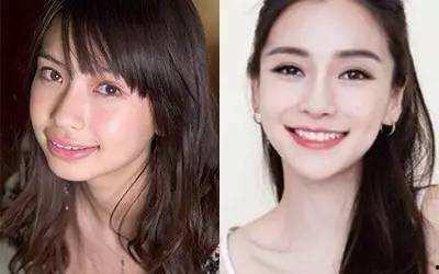 龅牙娱乐吃瓜,揭秘娱乐圈吃瓜背后的真相与笑料